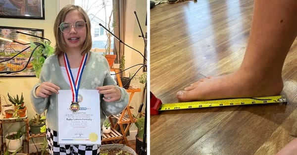 10-Year-Old Ruby bullied for big feet sets world record